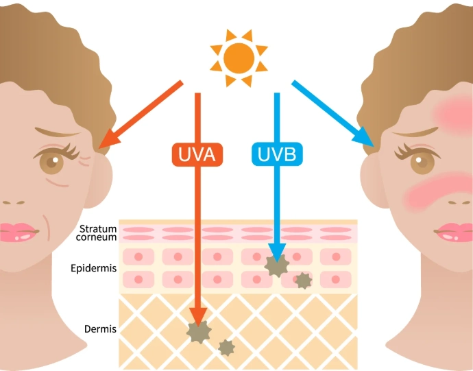 the effect of UVA and UVB rays on the skin
