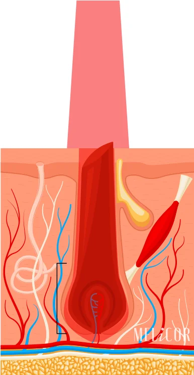 Conversione dell'energia laser in calore