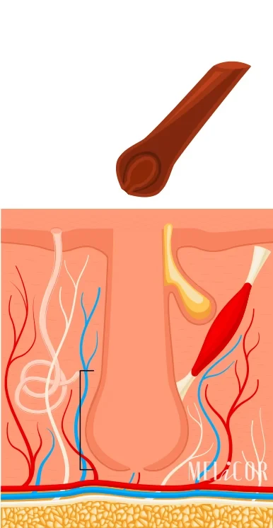 danni al follicolo, perdita di capelli