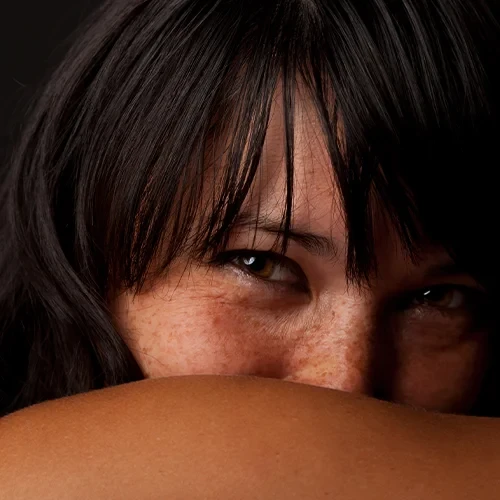 Donna con segni di fotoinvecchiamento