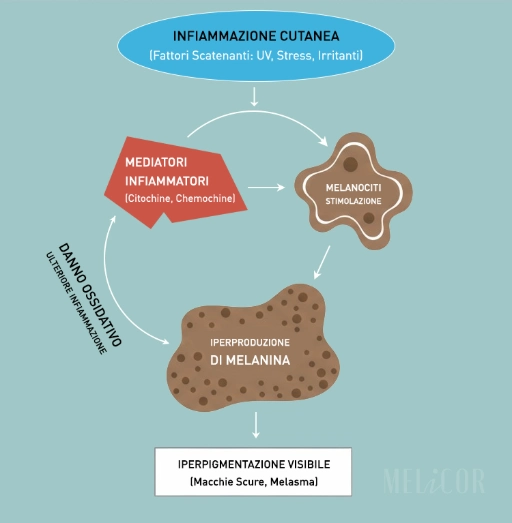 Schema scientifico del ciclo irritazione, infiammazione e sovrapproduzione di melanina nella PIH